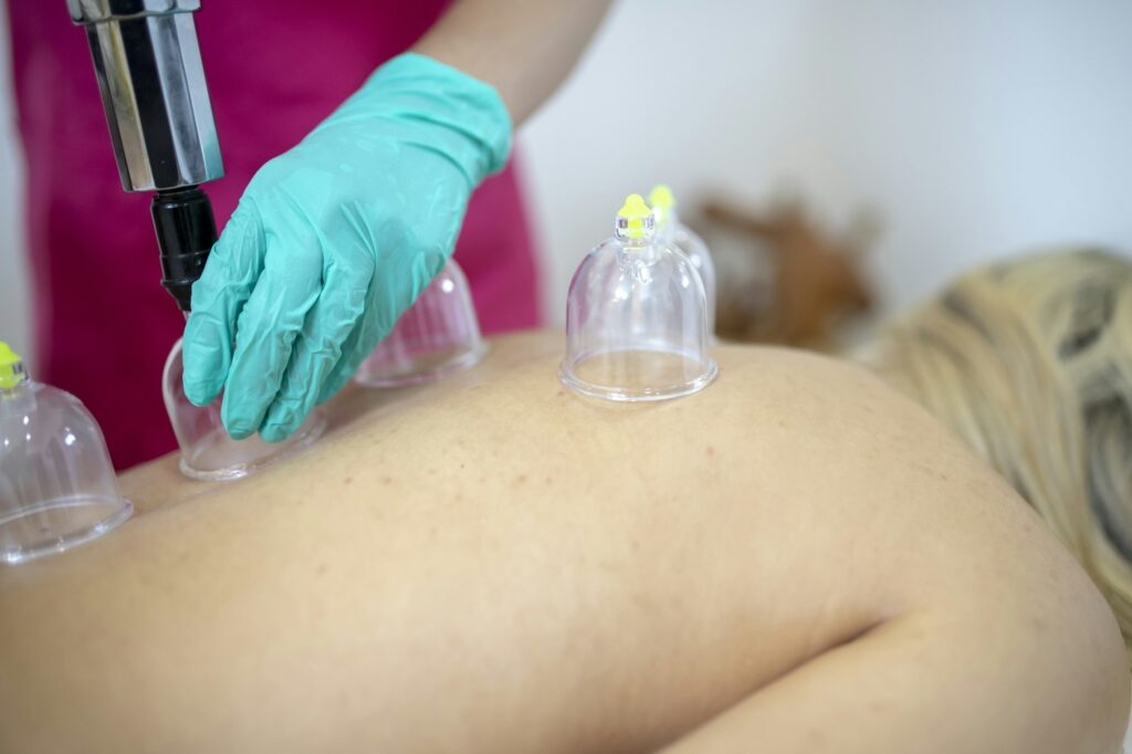 Shallow focus closeup of a female performing Ventosa cupping massage therapy to another female lying